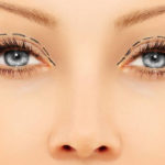 ptosis moorfields london