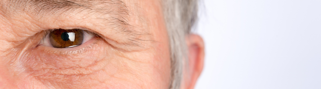 Revision Blepharoplasty London