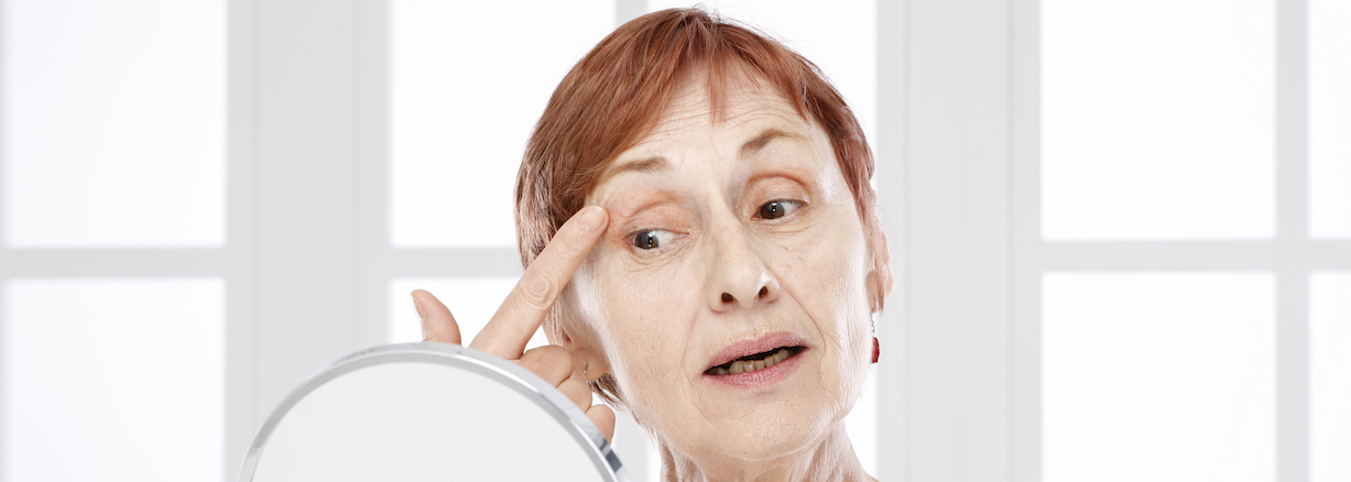 Revision Ptosis Repair London