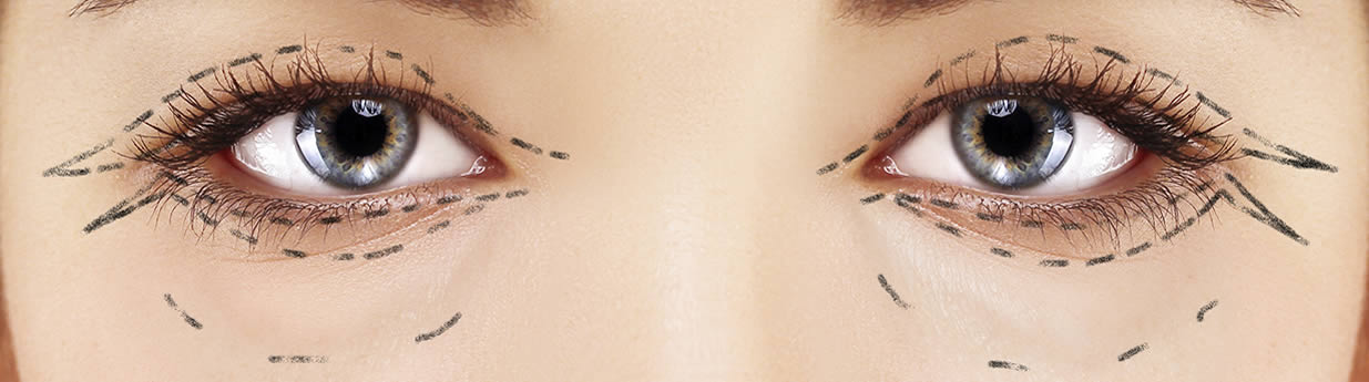 Functional Eye Surgery London