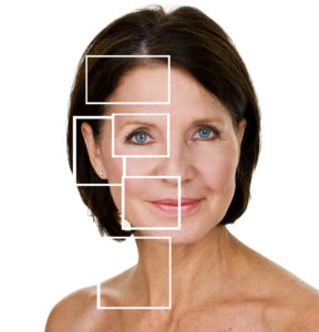 botox london