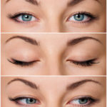 eyelid surgery moorfields london