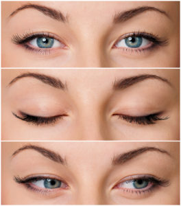 eyelid surgery harley street london