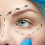 Congenital Ptosis In Children And Adults