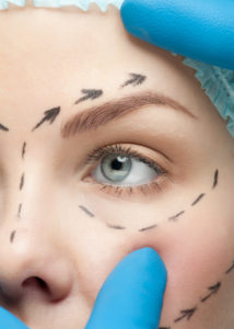 Congenital Ptosis in Adults & Children