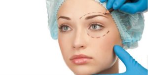 Eyelid Surgery